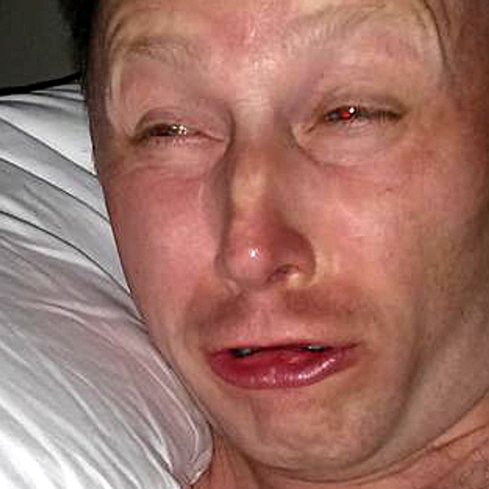 Limmy