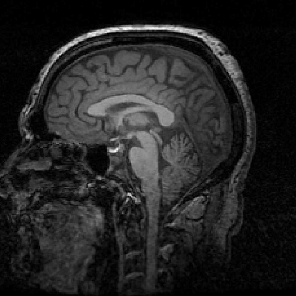 MRI Ken