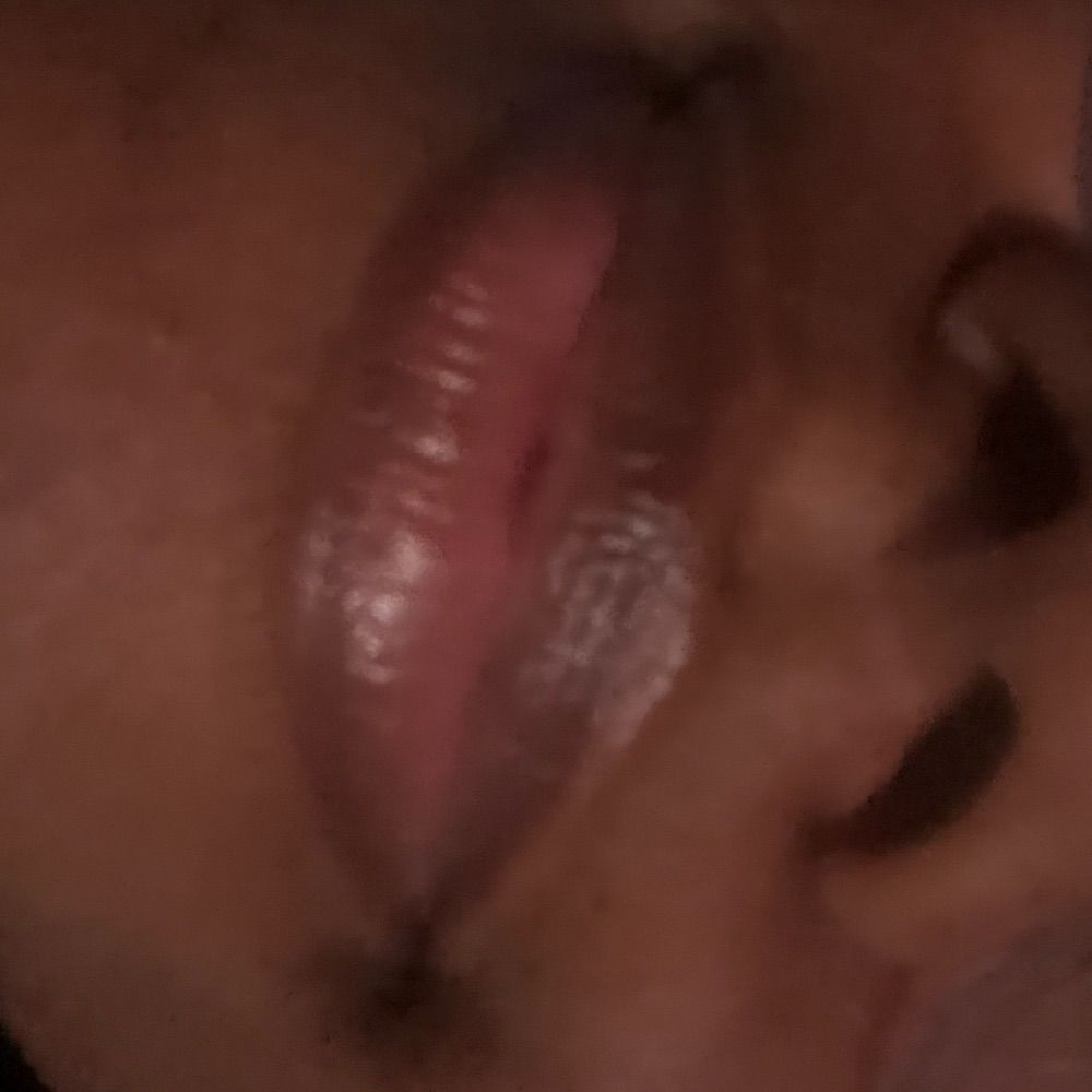 mkb