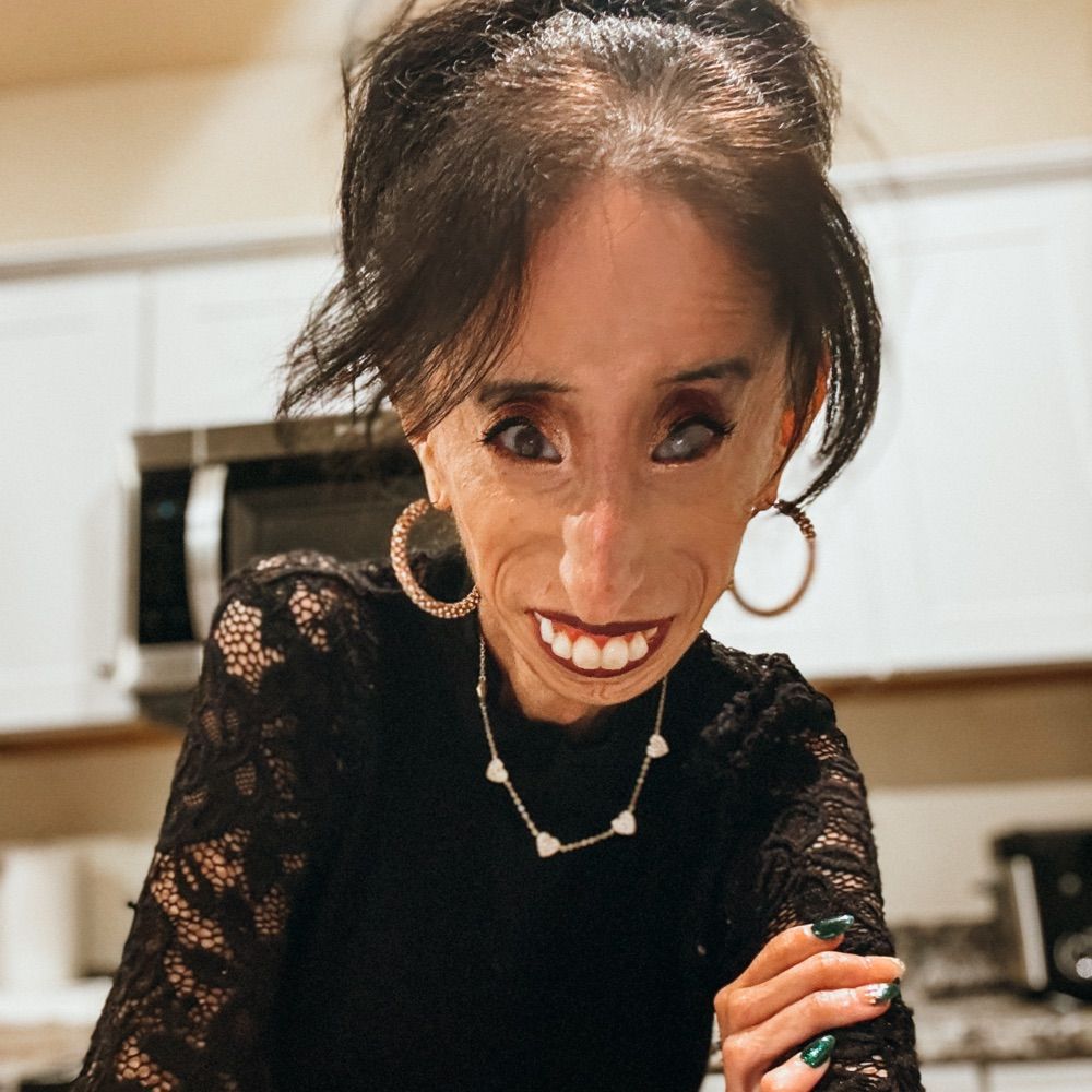 Lizzie Velasquez