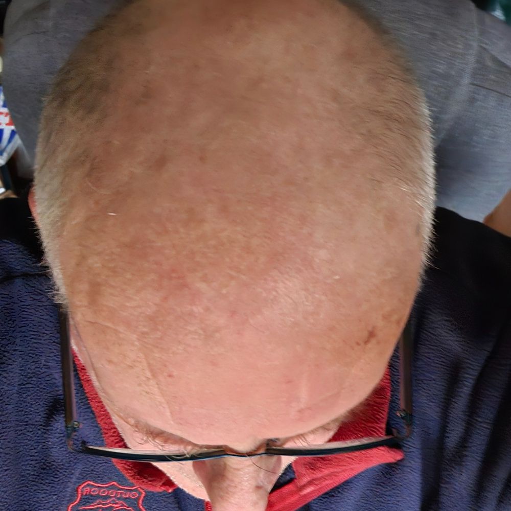 Chris the Bald
