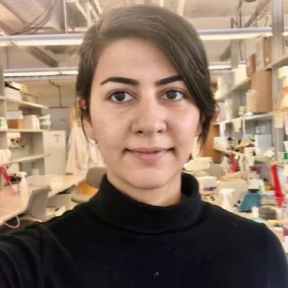 Yassi Aghazadeh