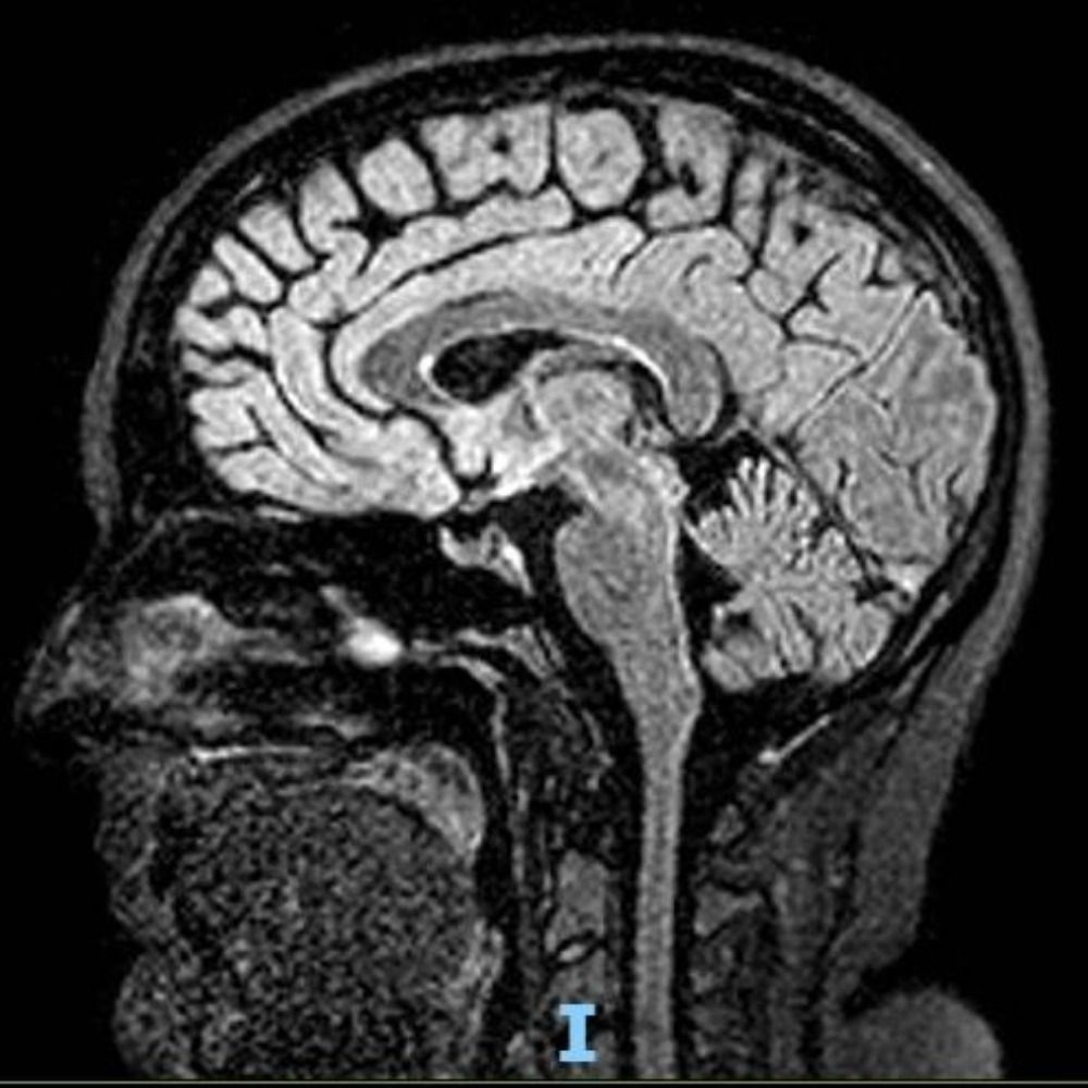 Encephalophagy