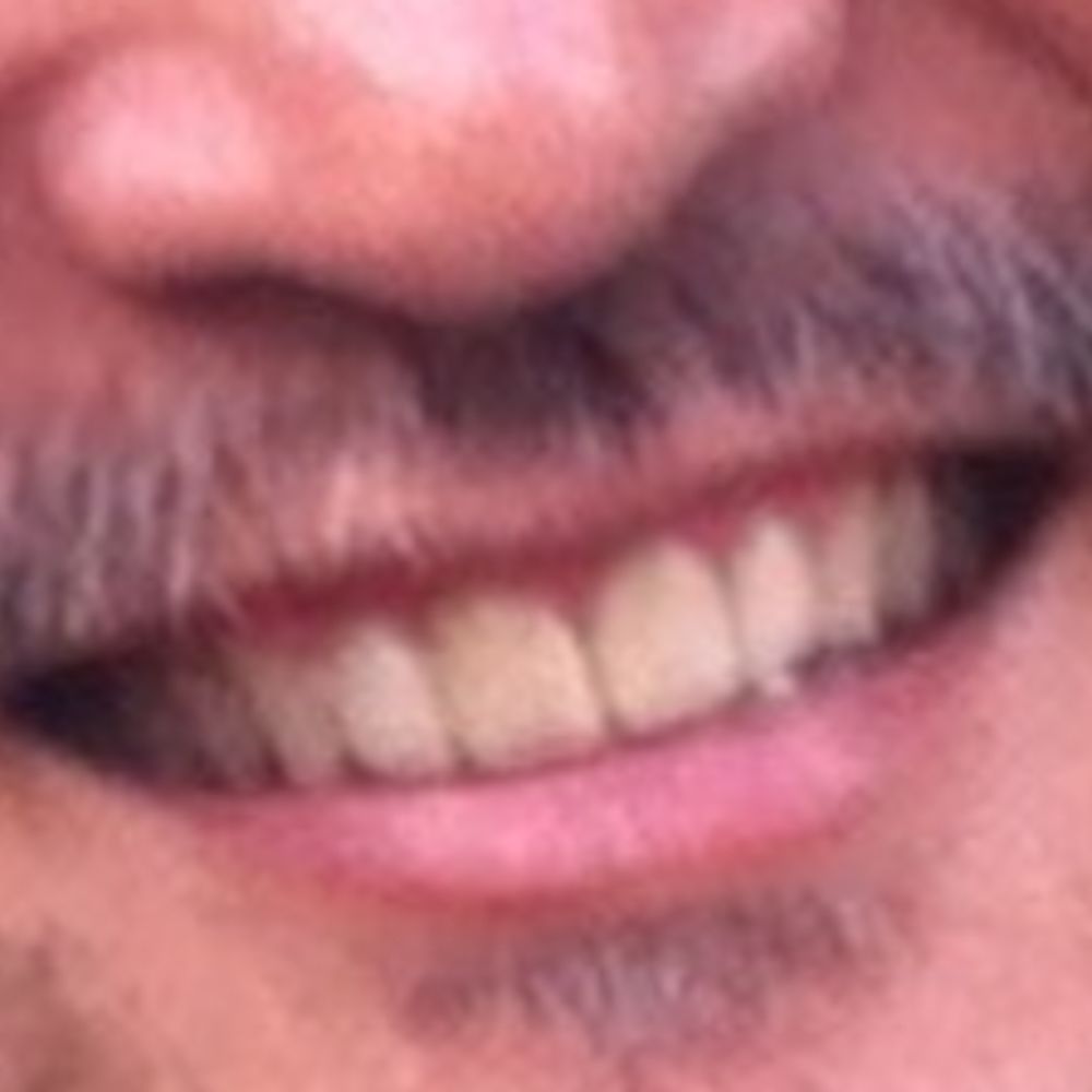 Higeguma