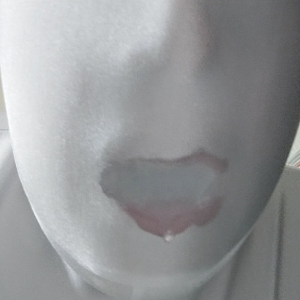 Apple Zentai Boy Encased
