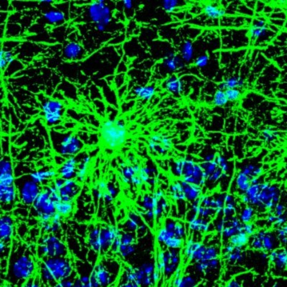 Italian Glia Network