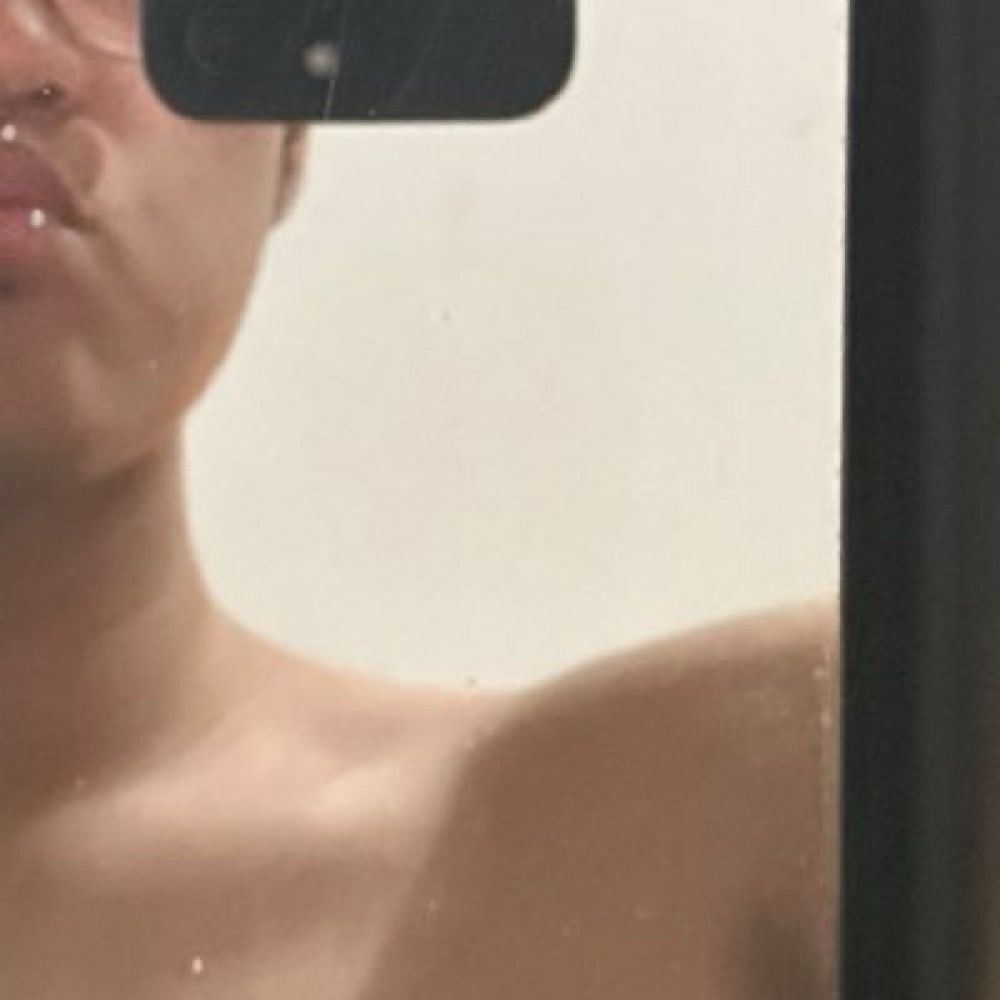 kio?