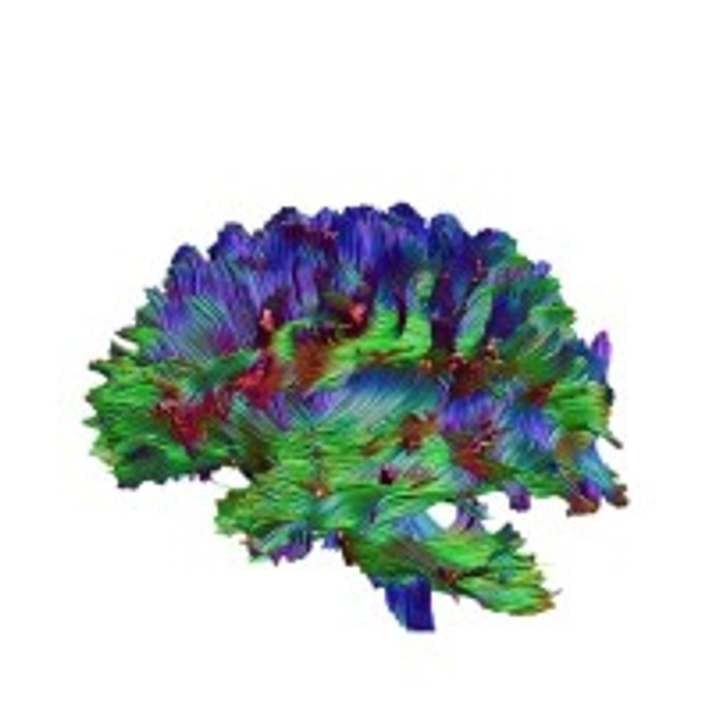 Galway Neuroscience Centre