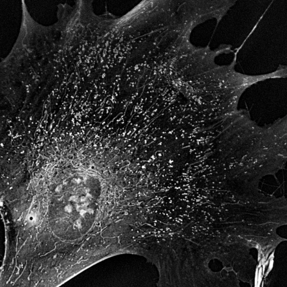 Holotomography | label-free 3D cell/tissue imaging