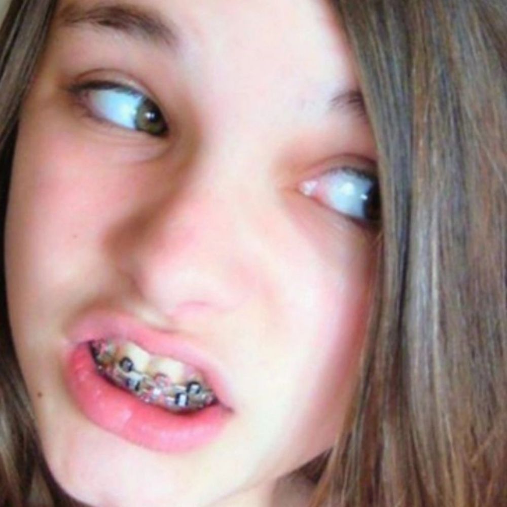 Chicks with Braces 🫶
