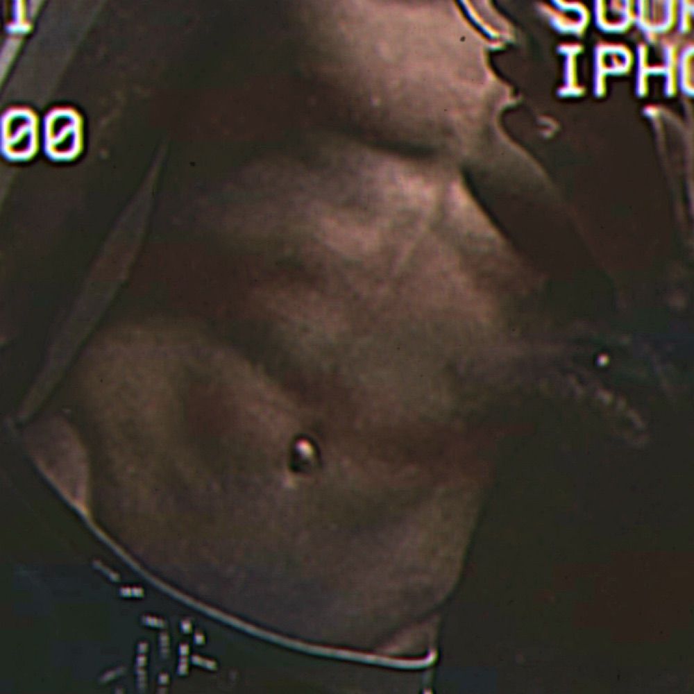 Urtwink?