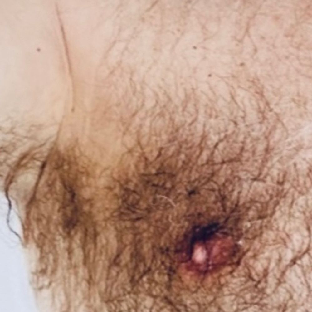 Leathernipples