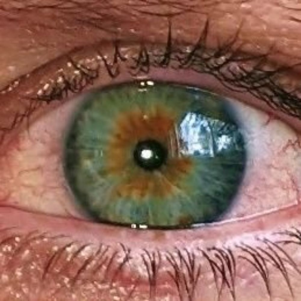 Two Red Eyes