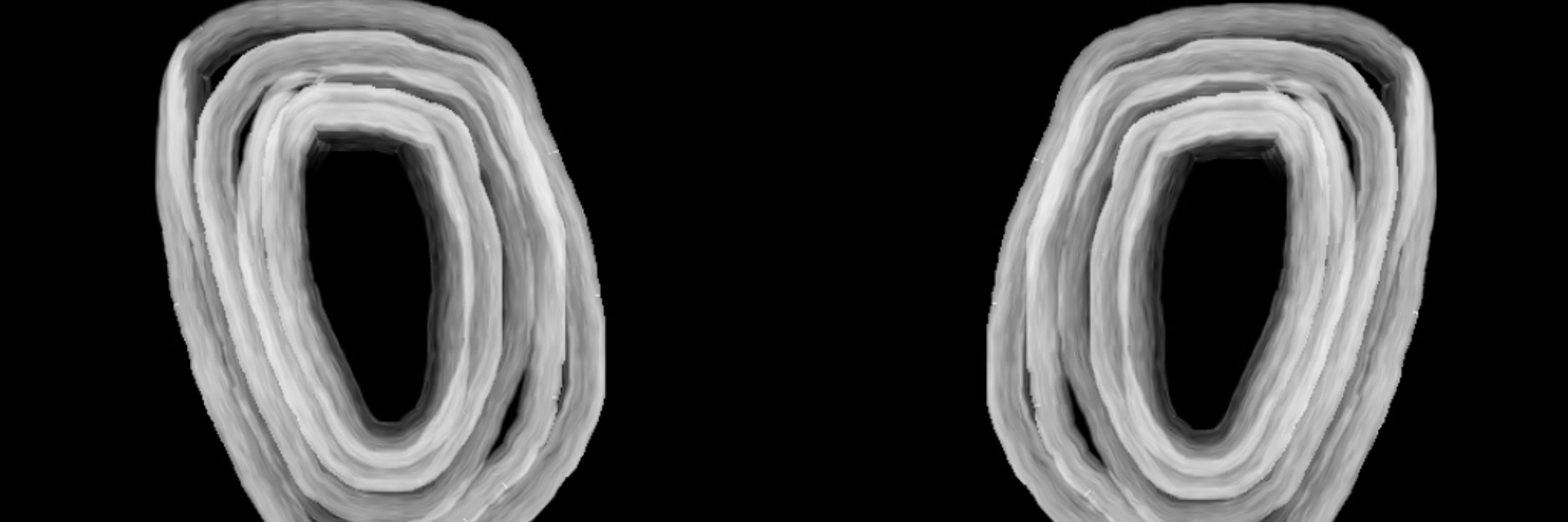 Osmostrix