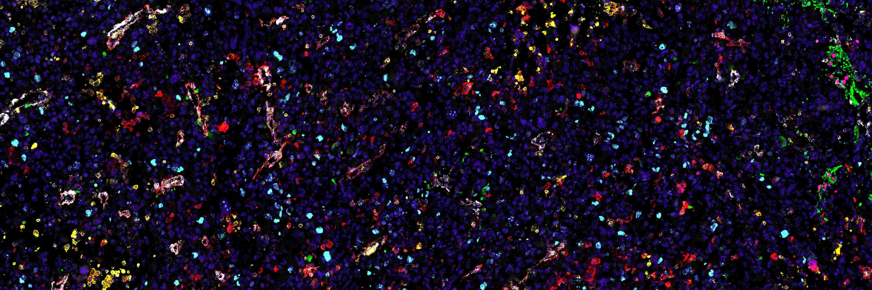 Institut Cancer et Immunologie