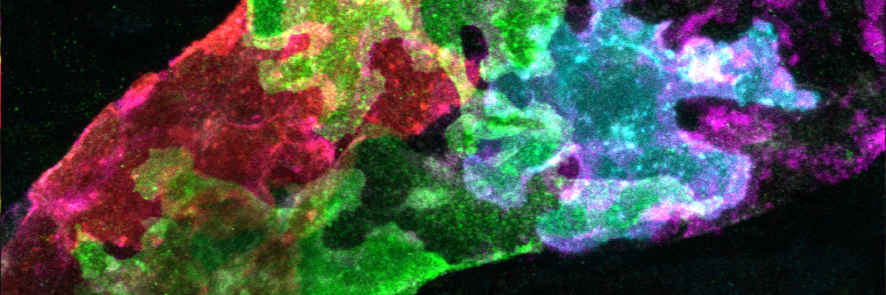 Makinen lab - Lymphatic Biology and Pathology