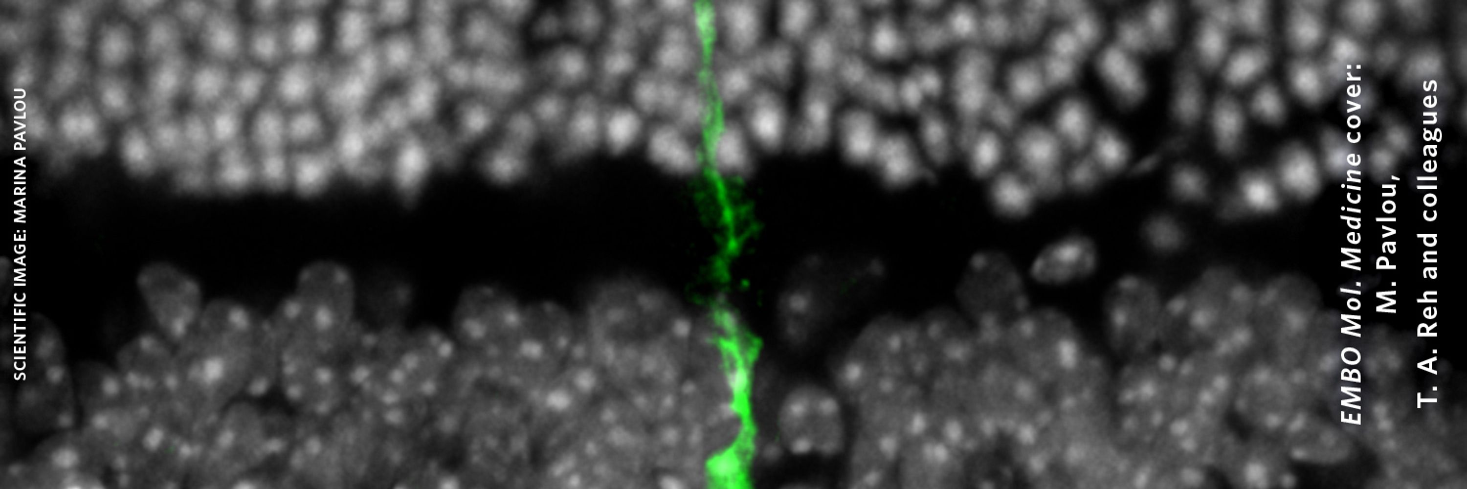 EMBO Molecular Medicine