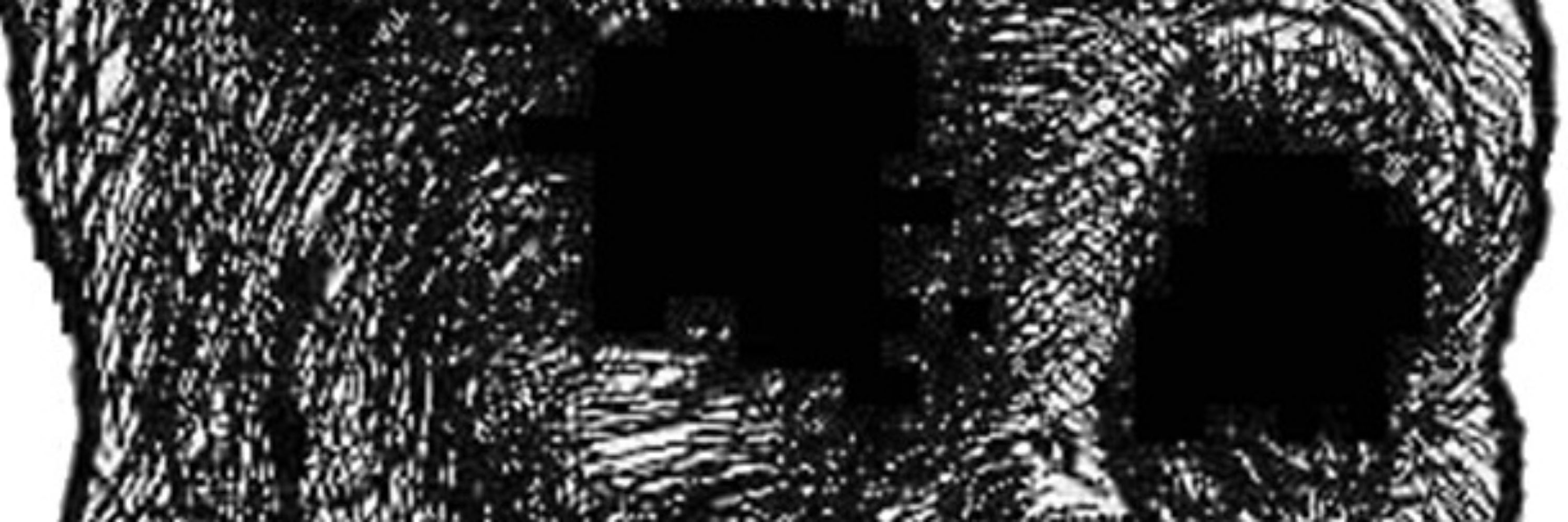 ARD