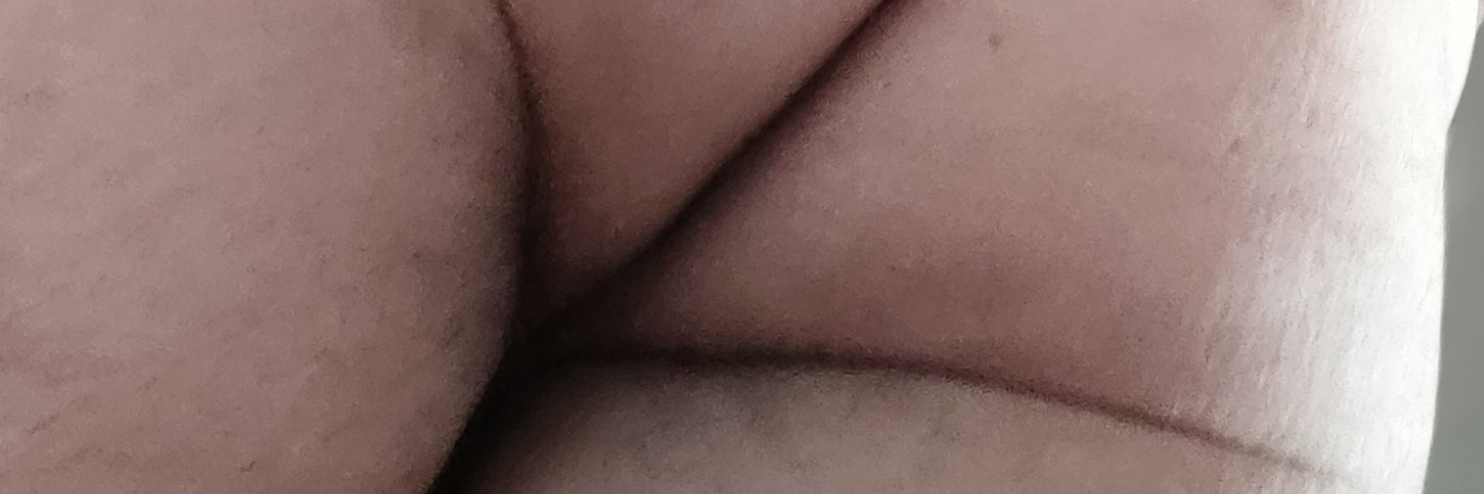 circulondulado