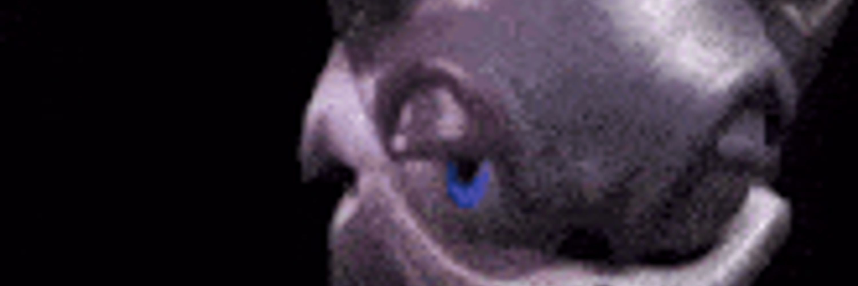 Egg (18 plus)