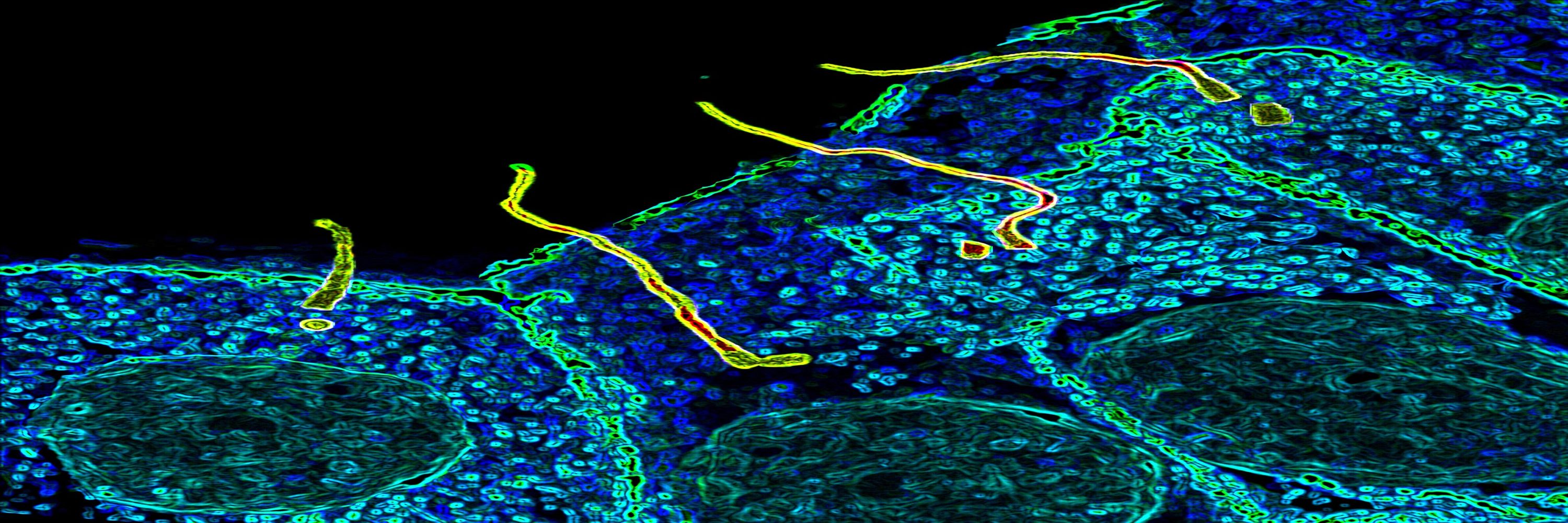 WashU Ciliopathy Research Group