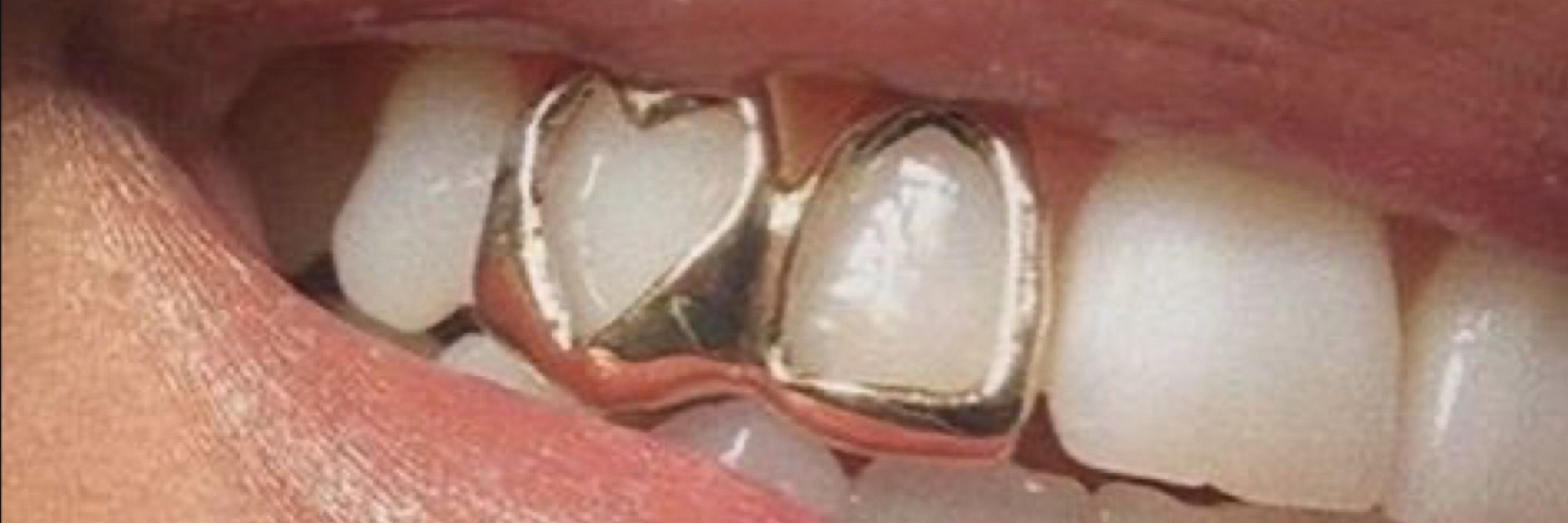 Trandi17