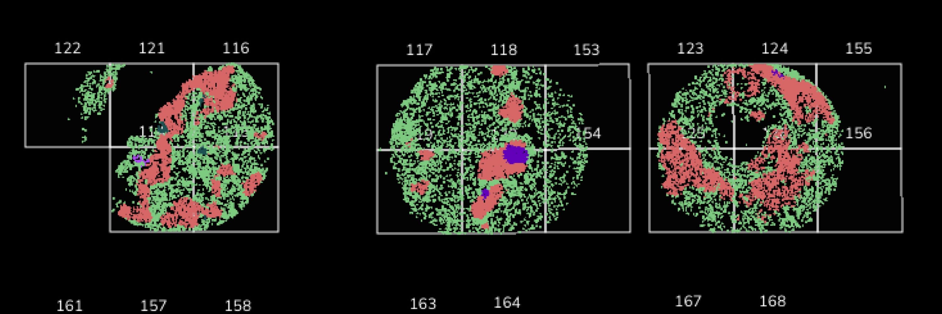 Spatial Genomics and Long Read Sequencing Service Provider, SG