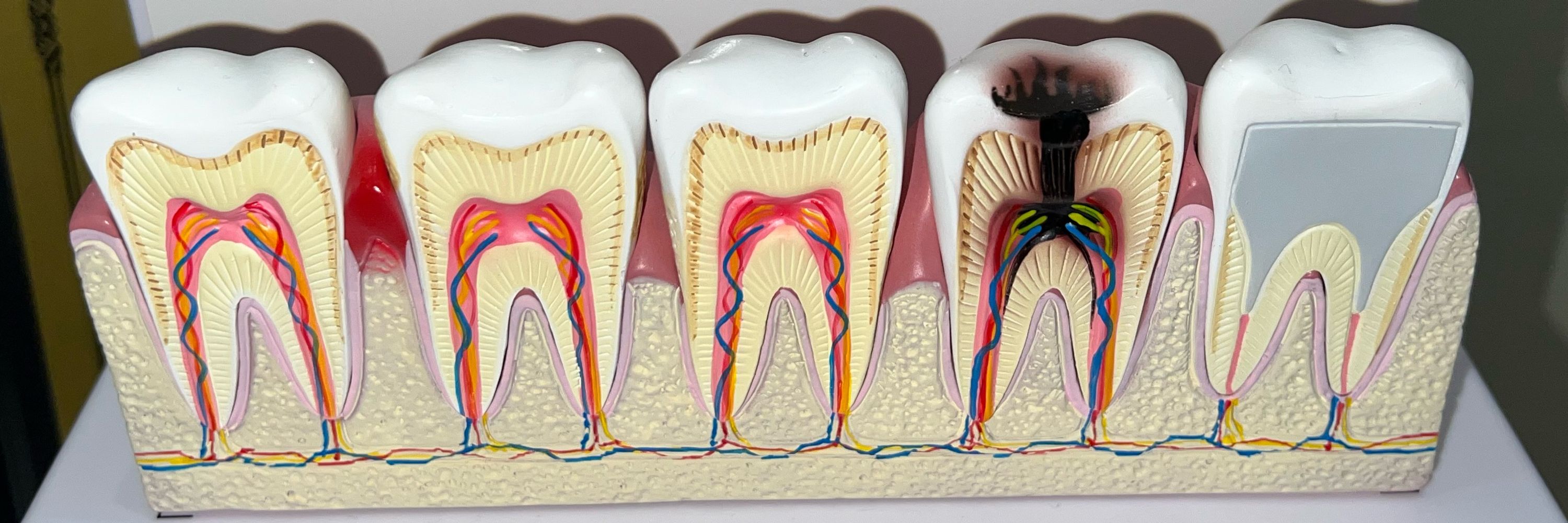 ♱ tooth ♱