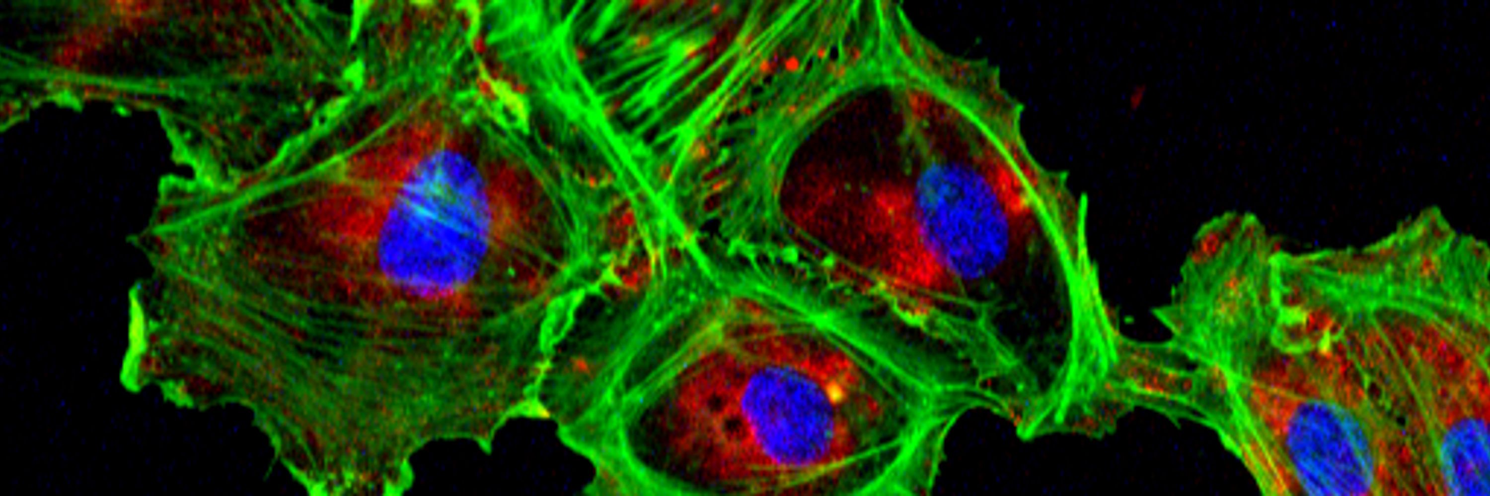 Institute for Vascular Signalling | IVS