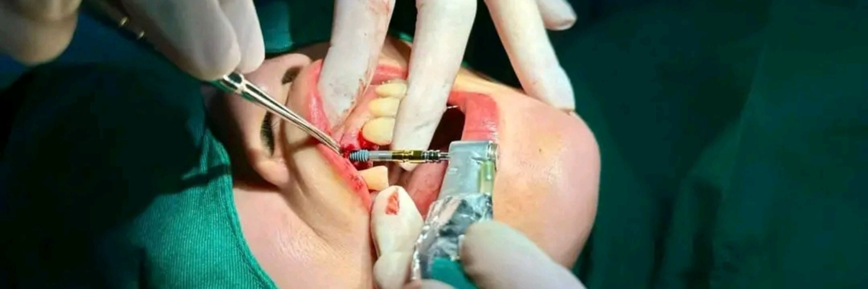 Dr Tuyen Nguyen 