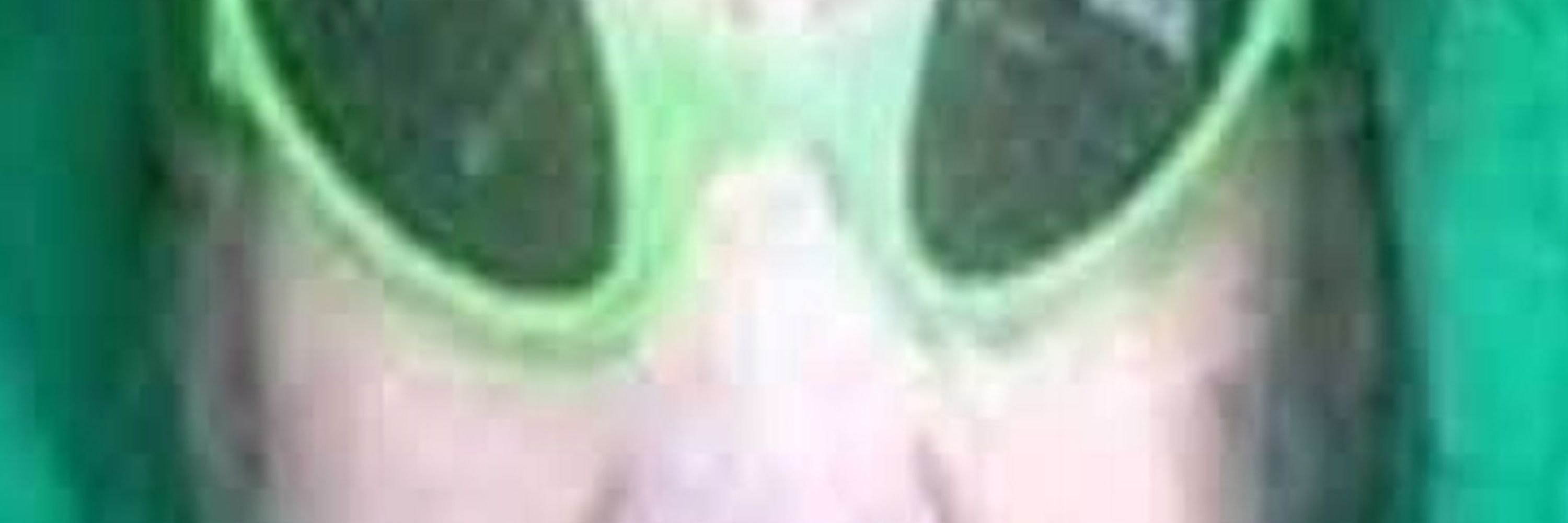Toperz
