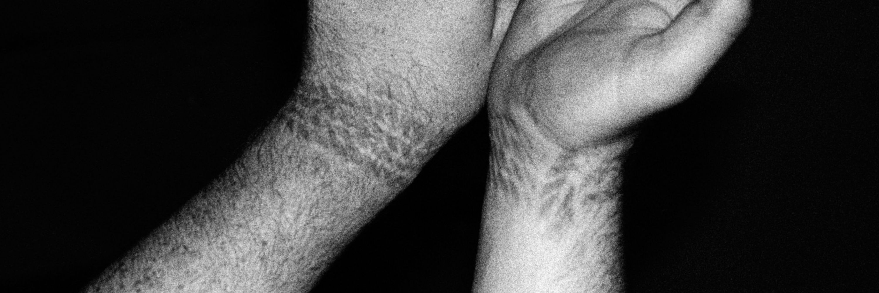 Germfree gets dirty