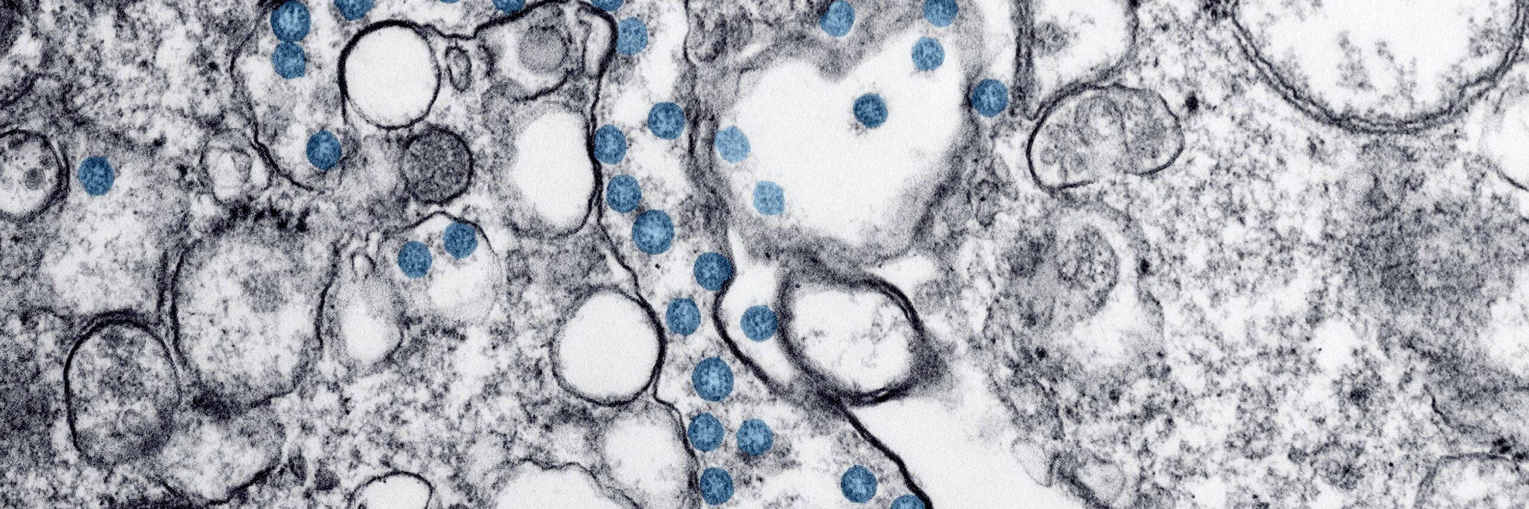 Le réseau MicroBio-NA