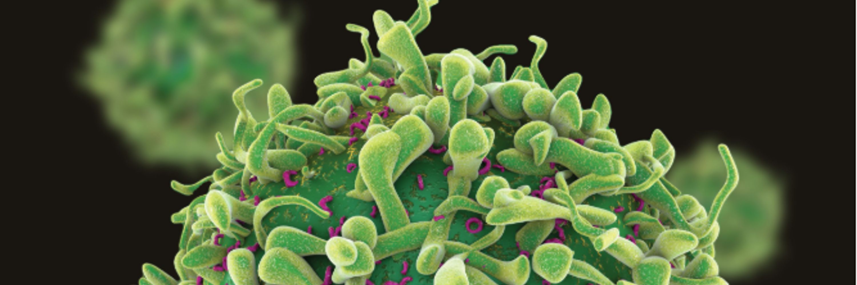 Carcinogenesis_Oxford Uni Press Journal