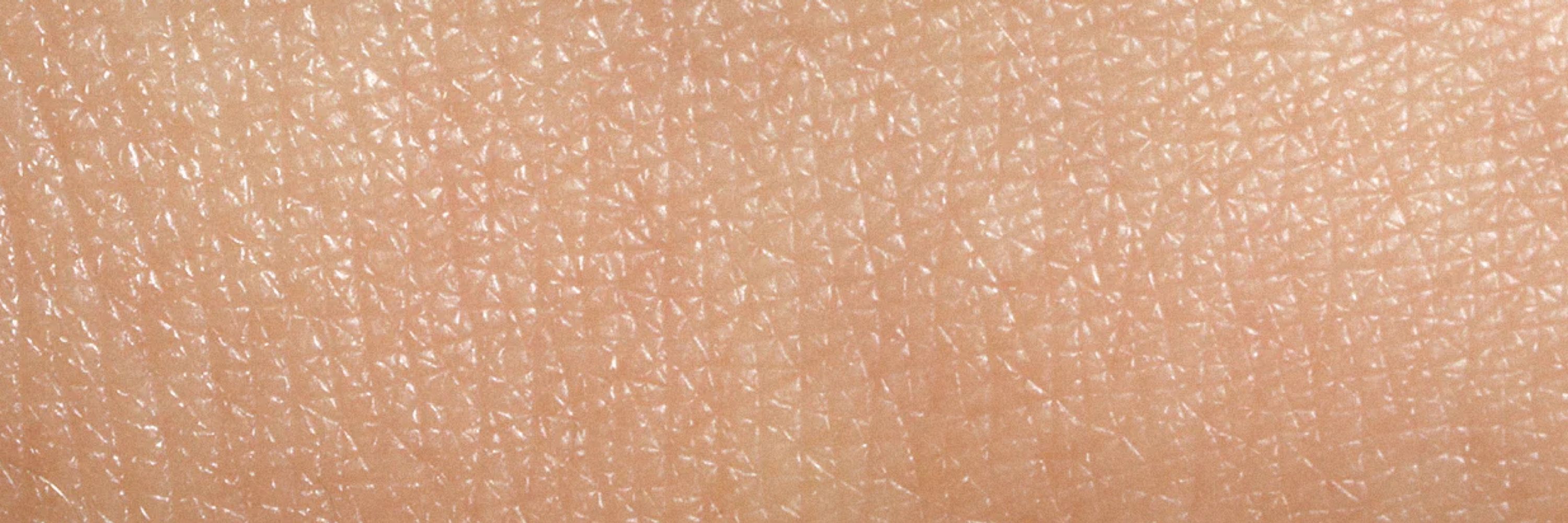 Mr. Skin