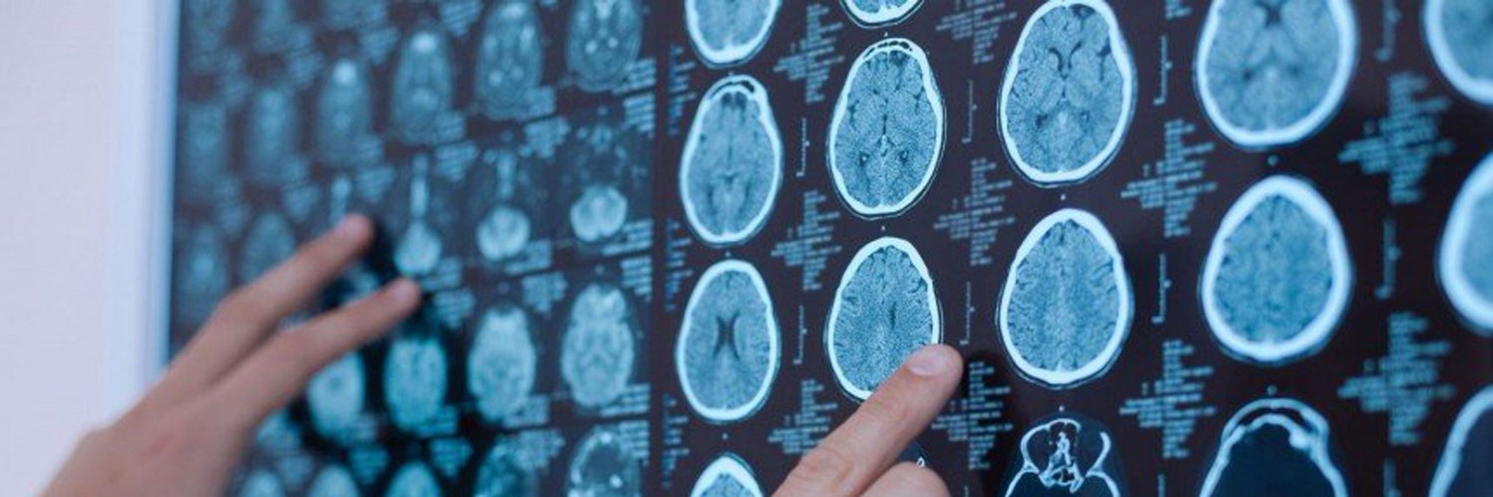 Neurological Alliance of Scotland