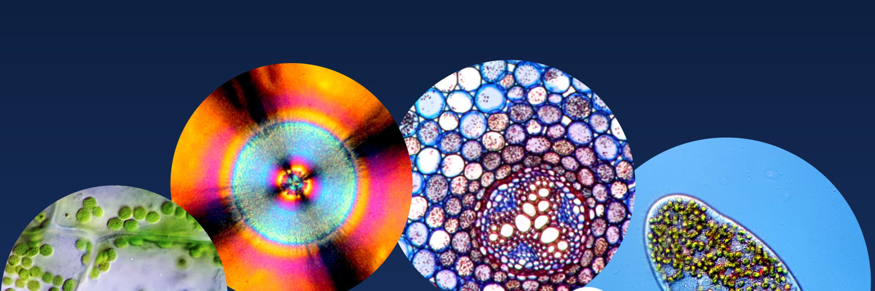 🔬 Microbehunter