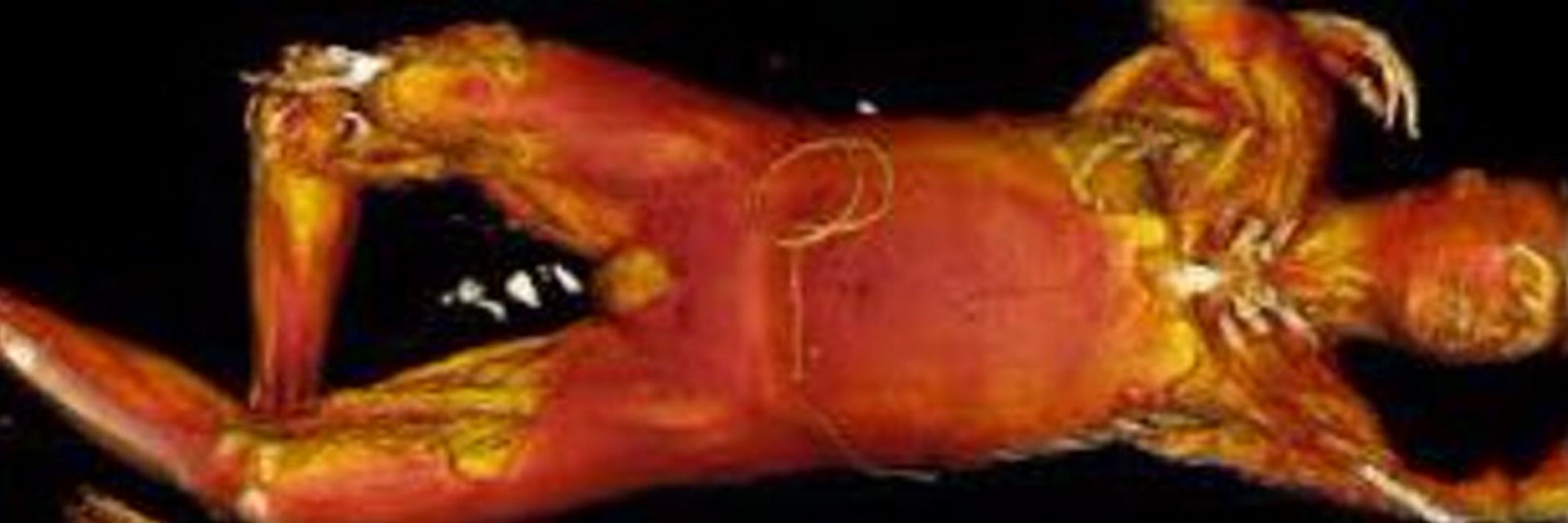 H.