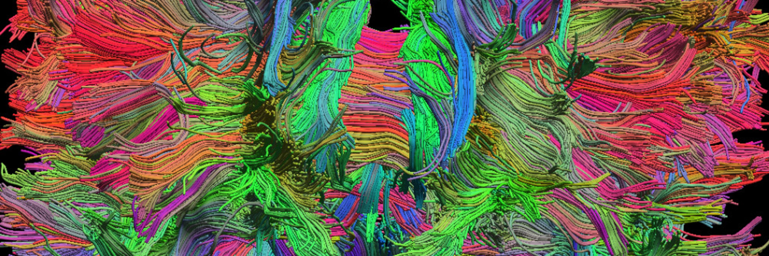 BrainSuite