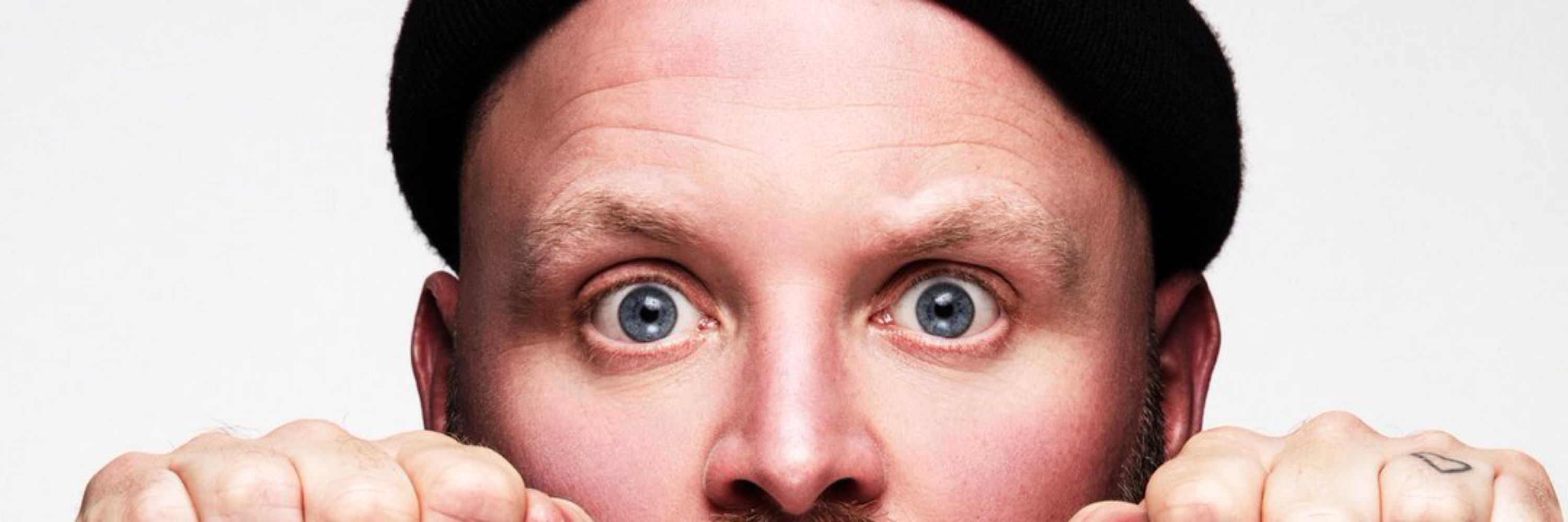 Arron Crascall