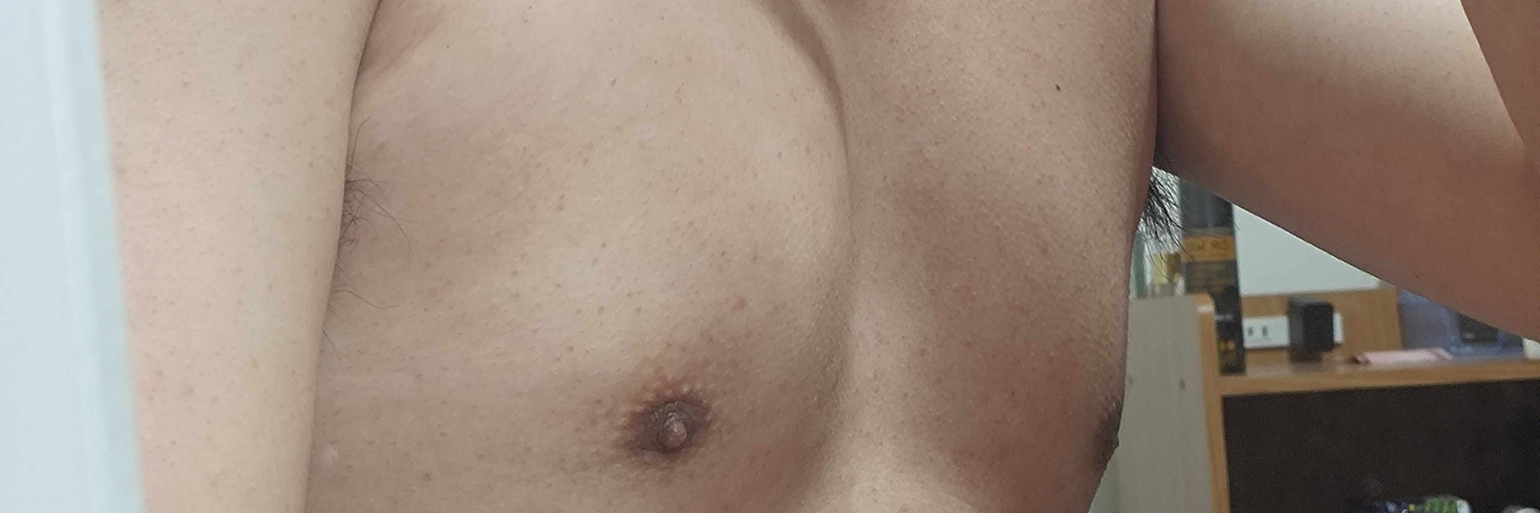 小林