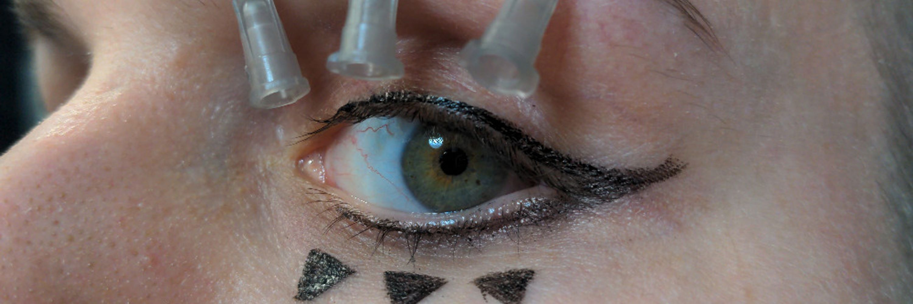 Vivivivisection