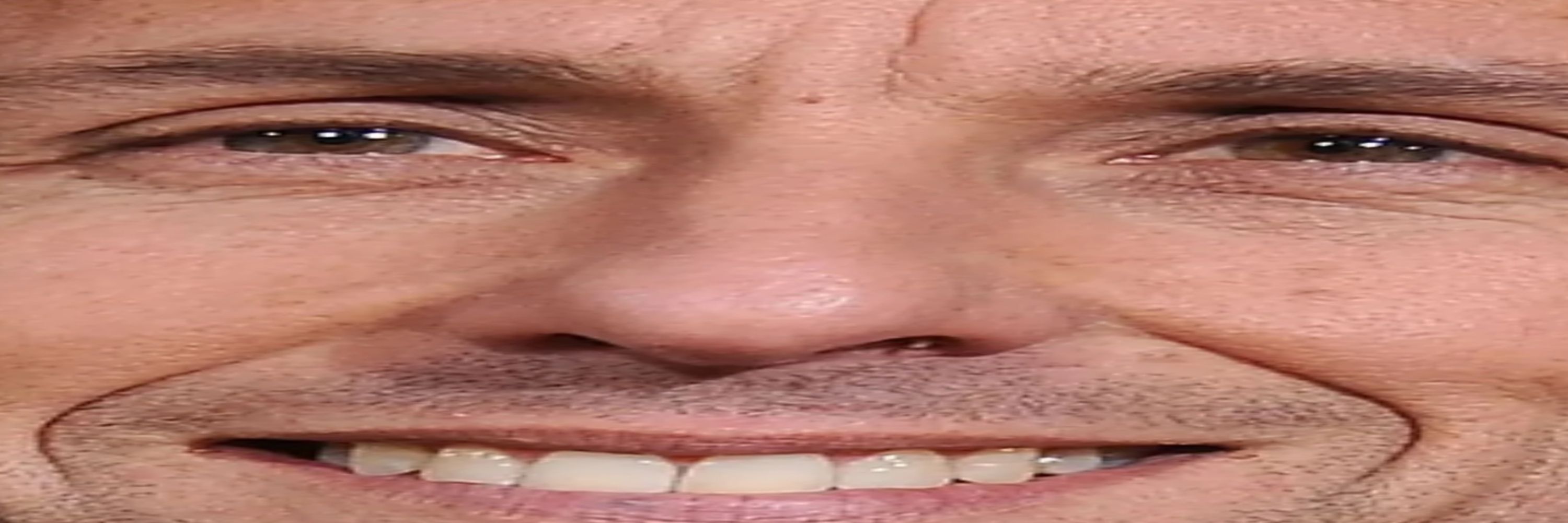 Numy