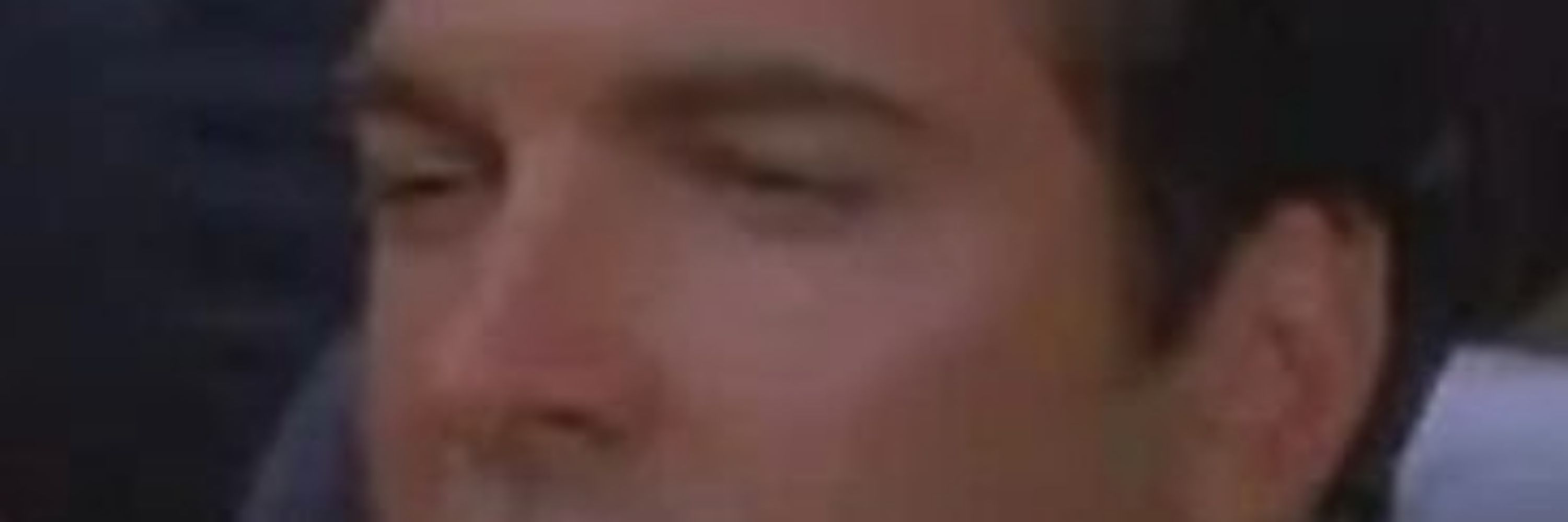 johnny deformed 