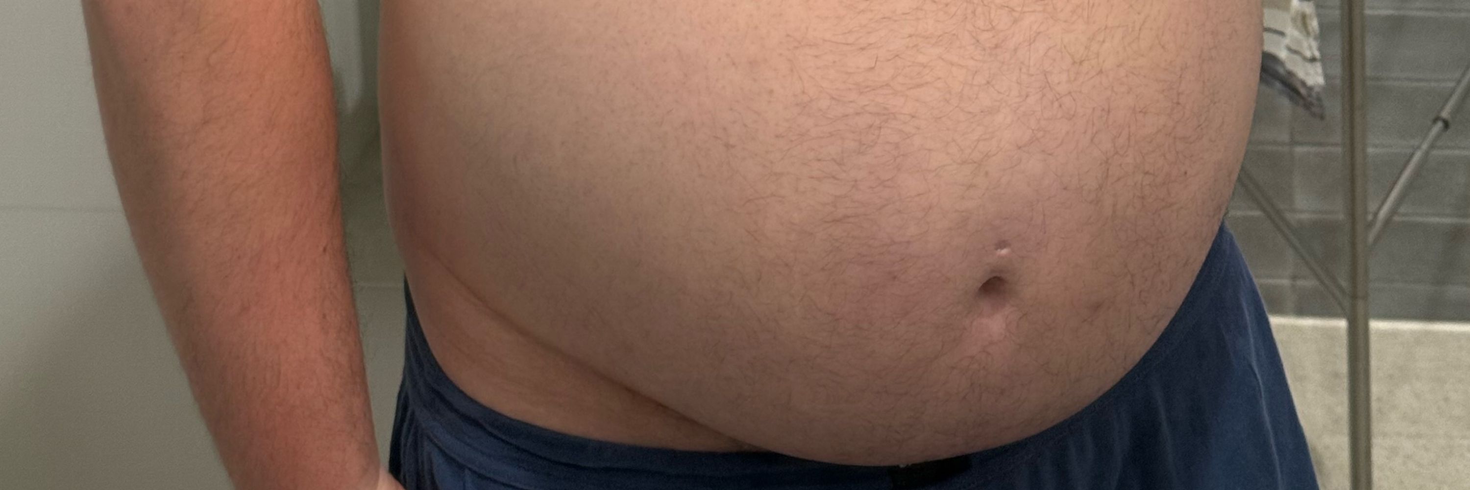 fat gut gainer