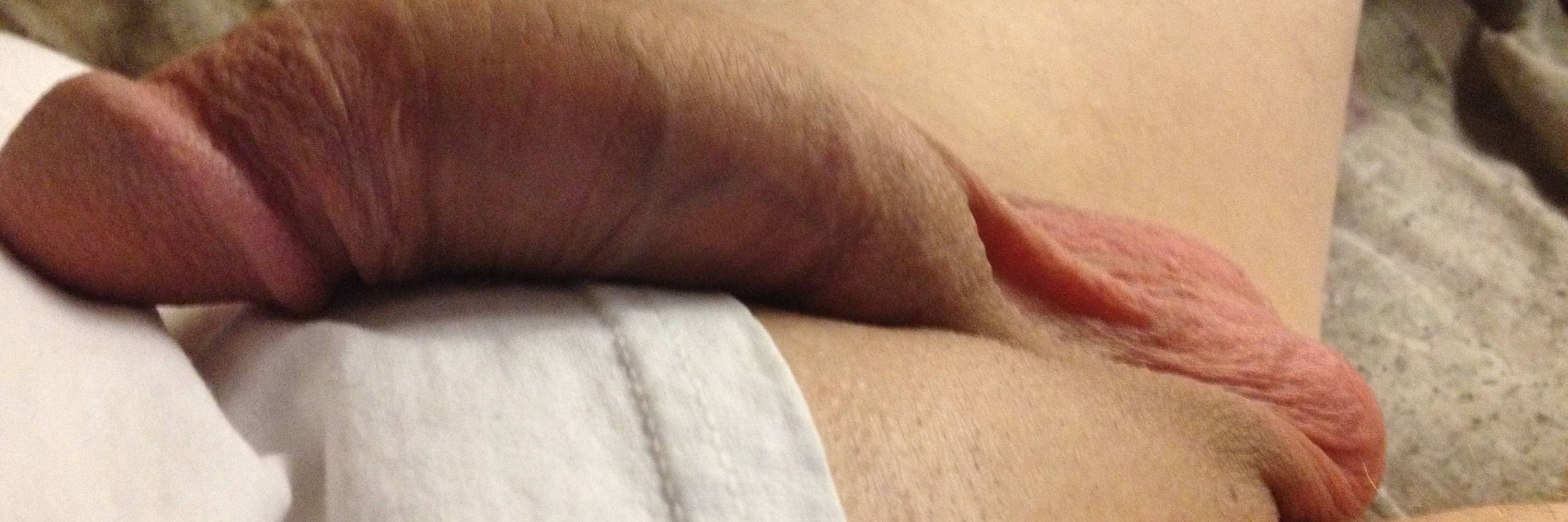 HUGE 