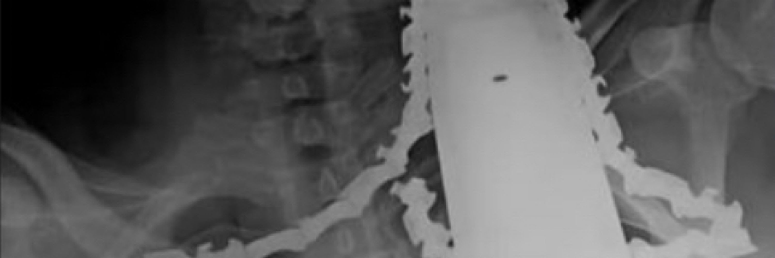 Trés Leeches