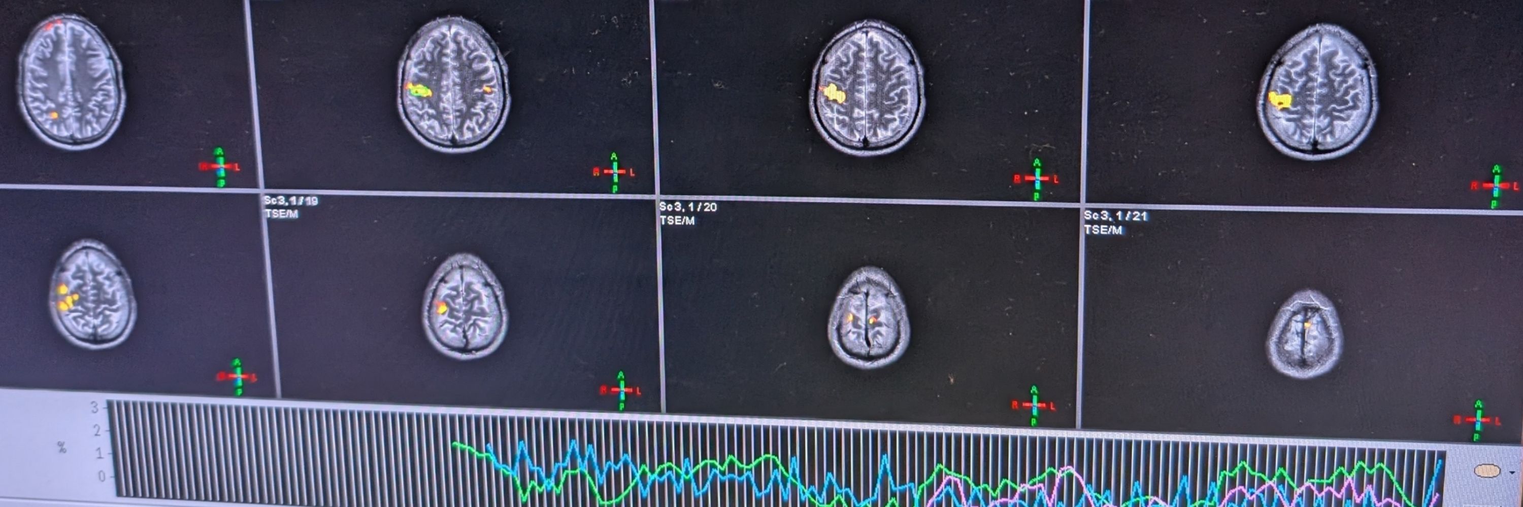 King's Perinatal Functional Imaging Group, Tomoki Arichi