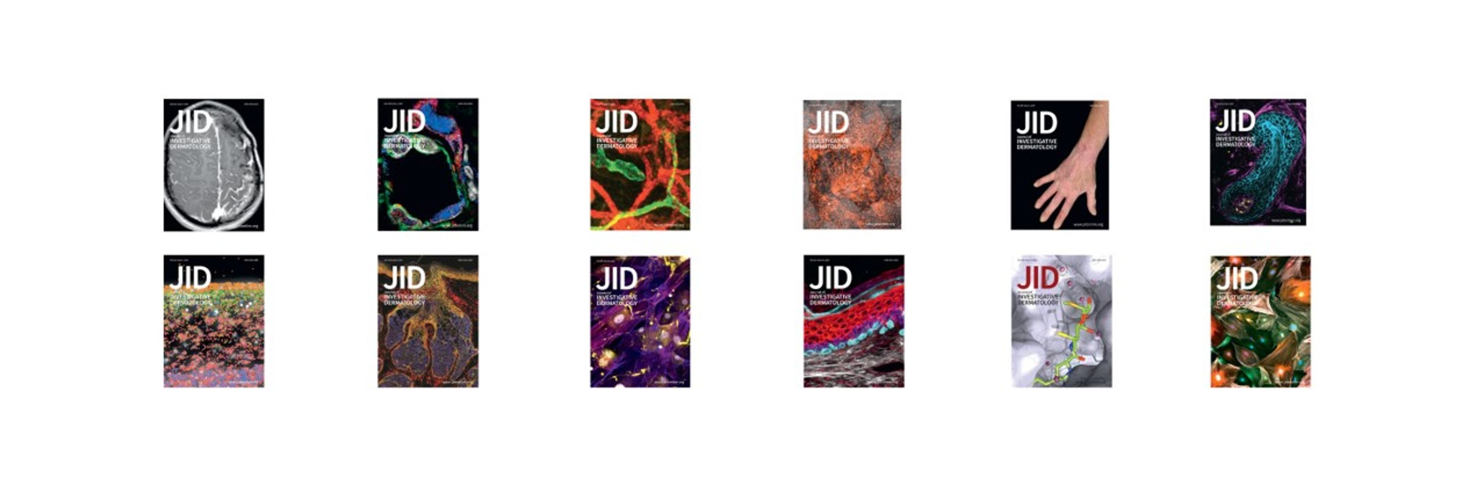 the JID Journal