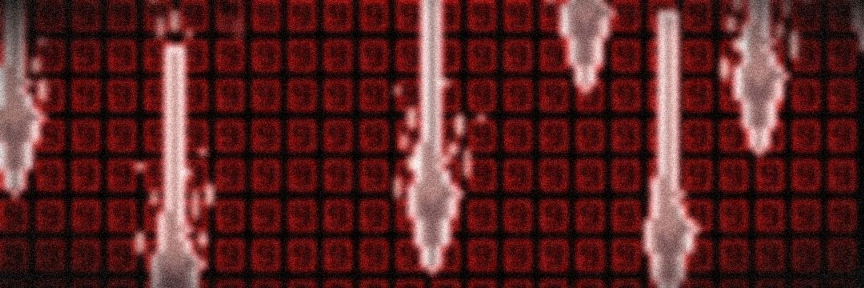 𝘜𝘯𝘥𝘺𝘳𝘢
